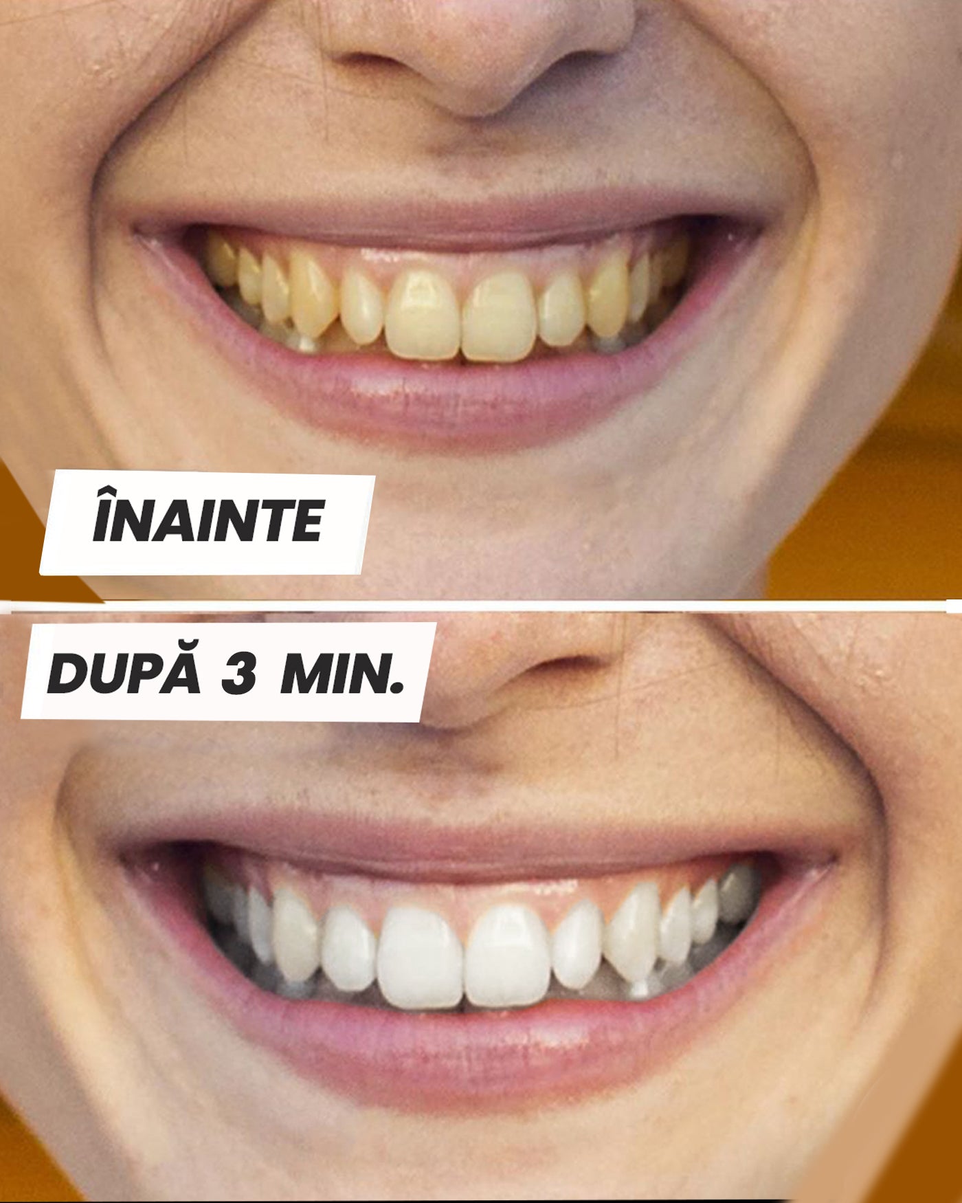 Pastă de albire a dinților.
