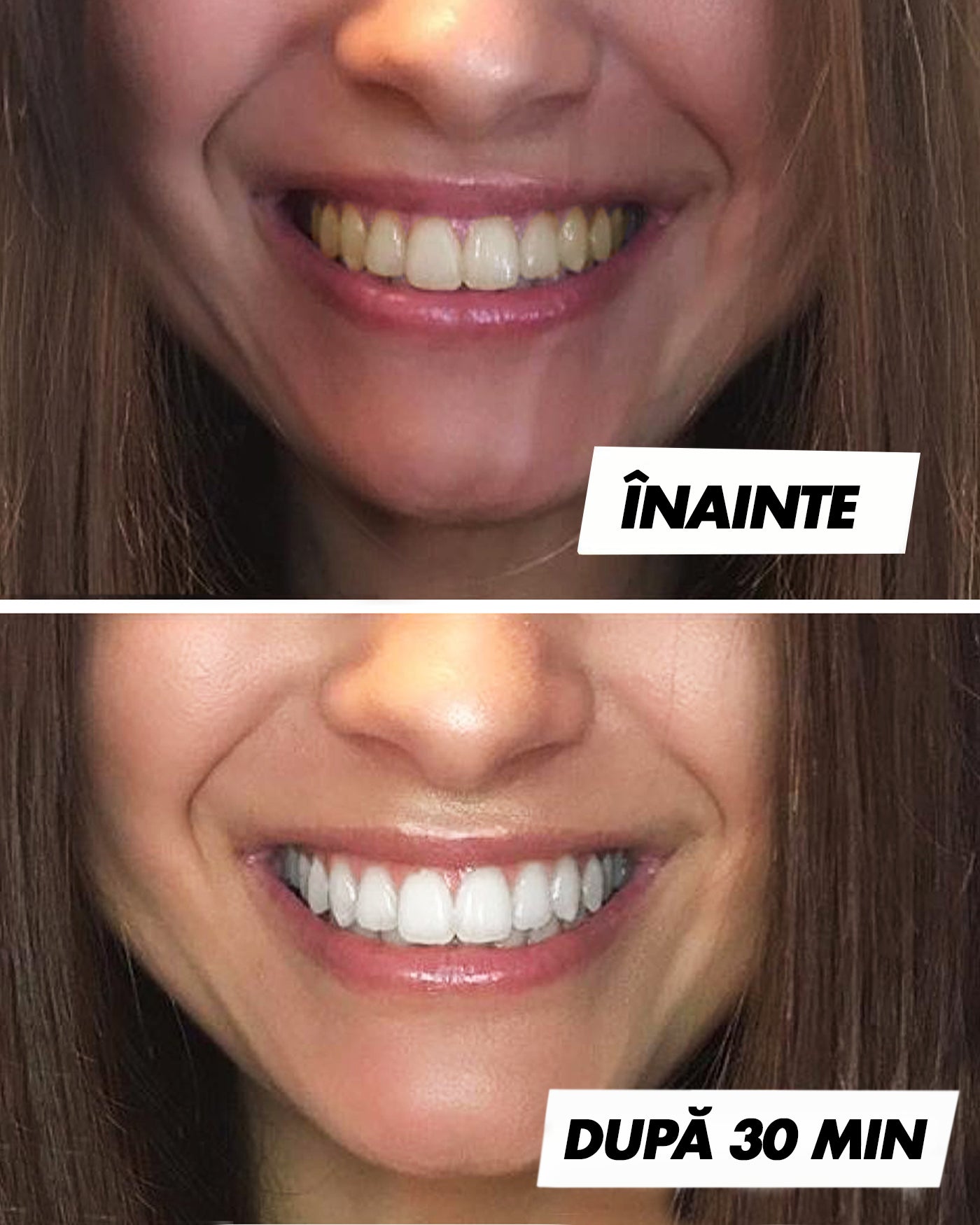 Set Benzi de albire + Pastă de albire a dinților